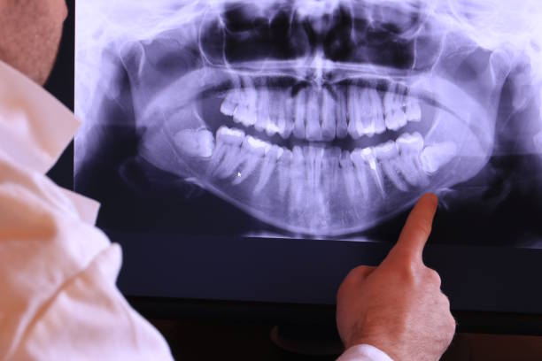 Best Pediatric Emergency Dentist in Heritage Lake, IL