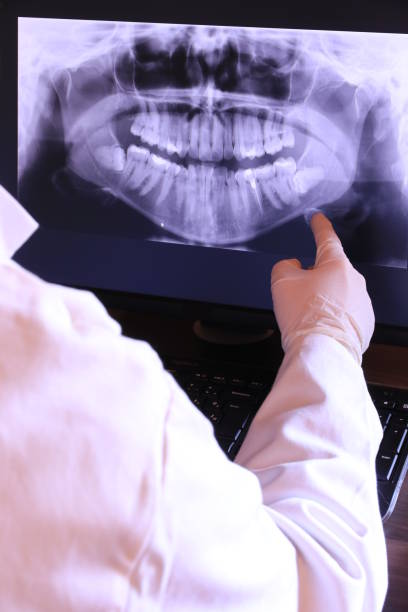 Best Emergency Dental Extractions in Heritage Lake, IL